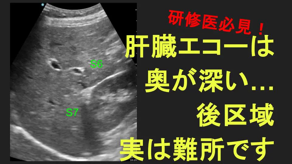 肝臓・後区域を観察しよう